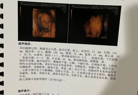 journal_insert_pic_1681164863