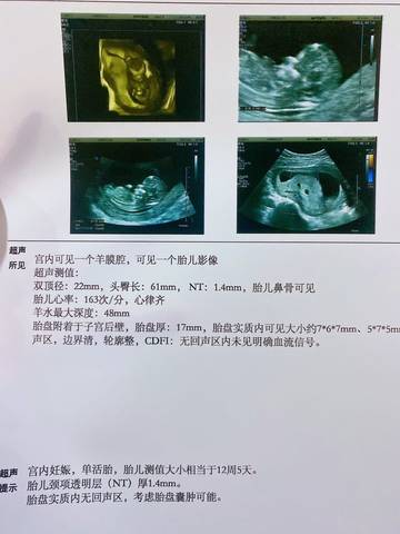 journal_insert_pic_1688148078