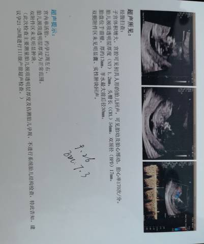 journal_insert_pic_1682568428