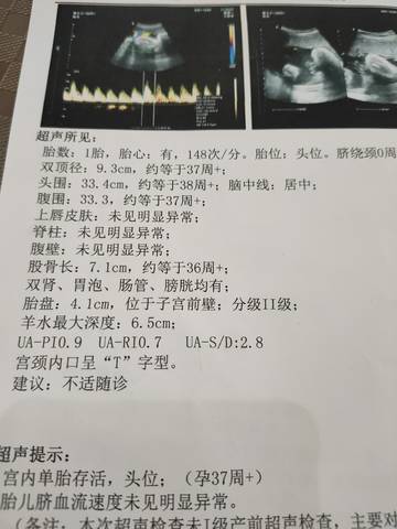 journal_insert_pic_1683049859