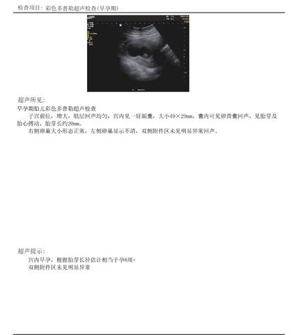 journal_insert_pic_1679552236