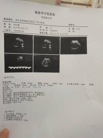 journal_insert_pic_1686342083