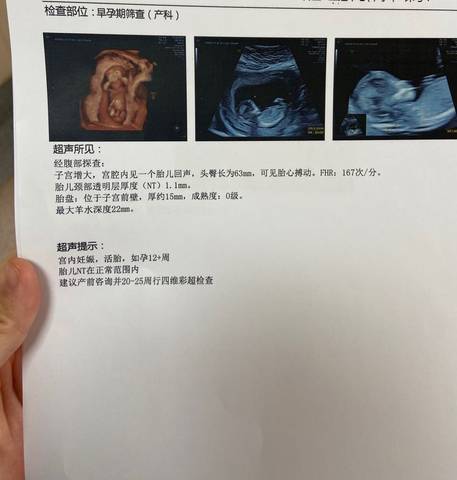 journal_insert_pic_1676394739