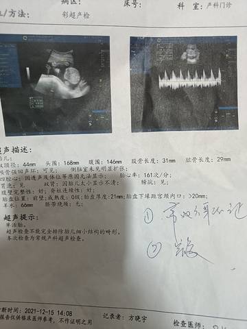 journal_insert_pic_1685603110