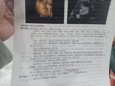 journal_insert_pic_1719585895