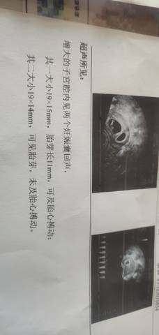 journal_insert_pic_1740814463