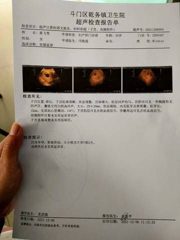 journal_insert_pic_1681849483