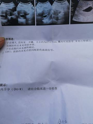 journal_insert_pic_1690081846