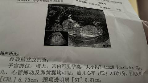 journal_insert_pic_1684130943