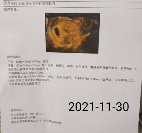 journal_insert_pic_1676323951