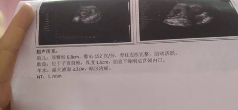 journal_insert_pic_1675125076