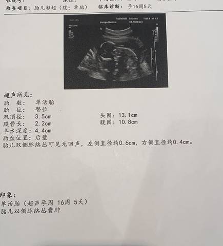 journal_insert_pic_1690282354