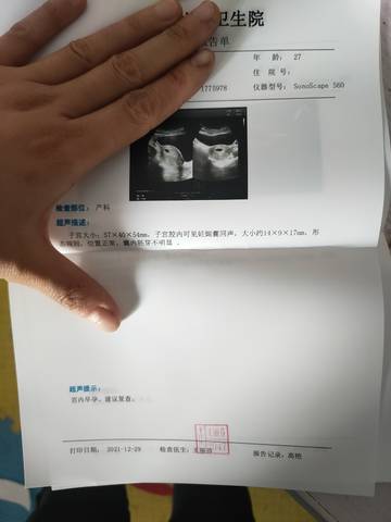journal_insert_pic_1688357926