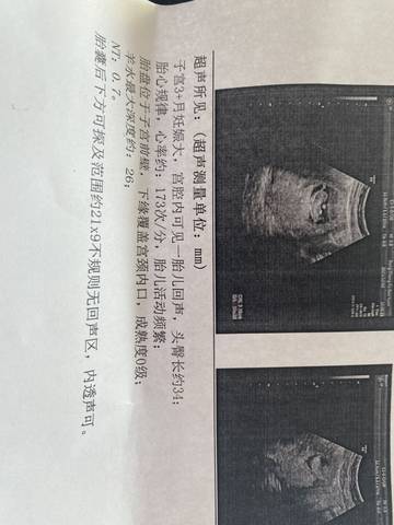 journal_insert_pic_1674138944