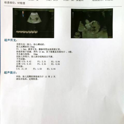 journal_insert_pic_1675547640