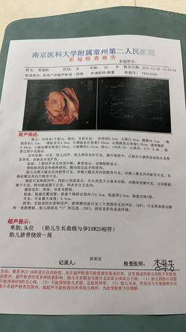 journal_insert_pic_1682182762
