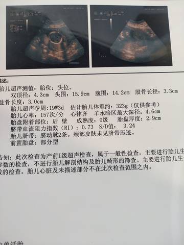 journal_insert_pic_1741030264