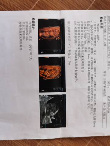 journal_insert_pic_1673945668