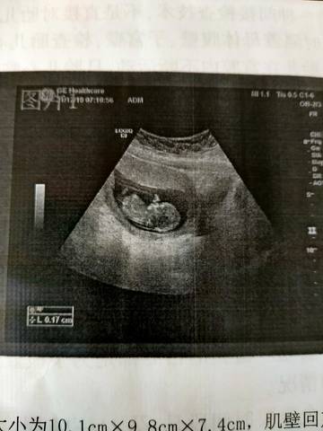 journal_insert_pic_1683584689