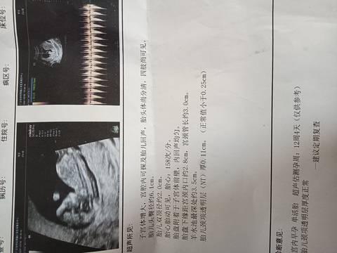 journal_insert_pic_1673399845