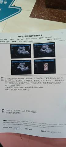 journal_insert_pic_1719535888