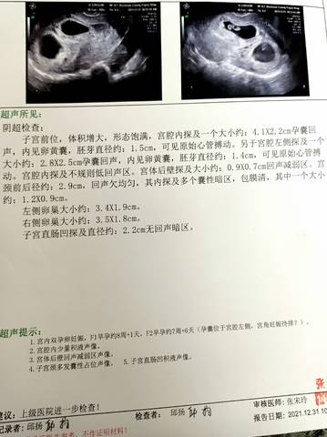 journal_insert_pic_1690014327