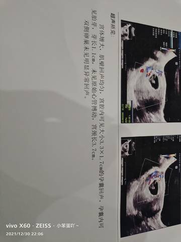 journal_insert_pic_1689212054