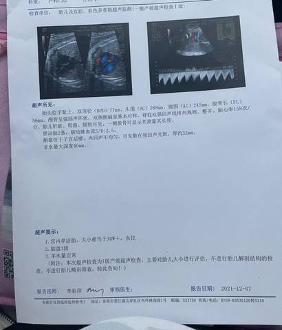 journal_insert_pic_1675582193
