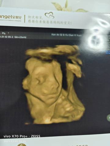 journal_insert_pic_1674290238