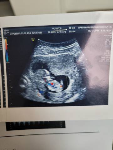 journal_insert_pic_1676602416