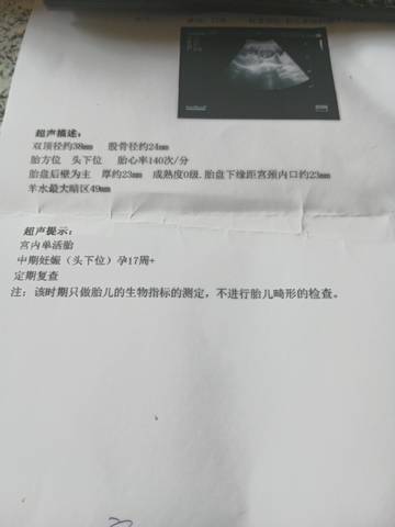 journal_insert_pic_1673413469