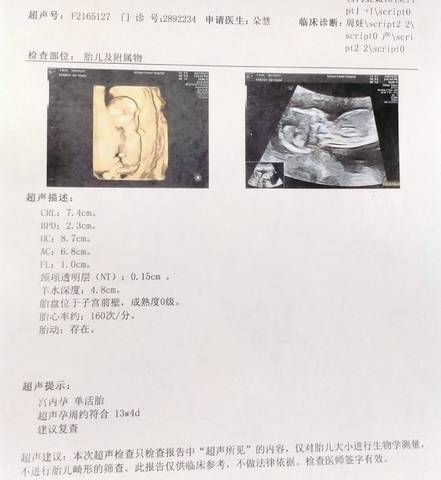 journal_insert_pic_1687320217