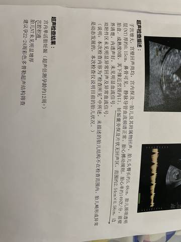 journal_insert_pic_1687791568