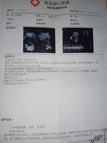 journal_insert_pic_1677556478
