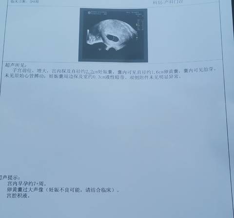 journal_insert_pic_1673371072