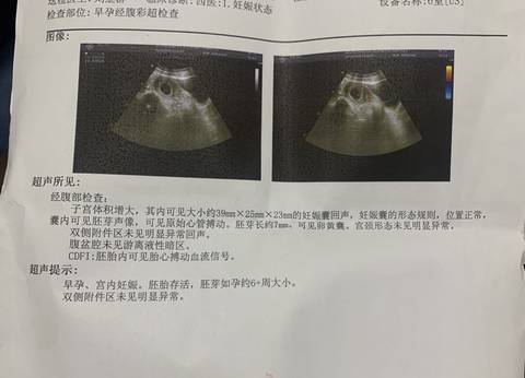 journal_insert_pic_1684327475