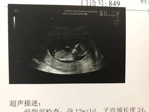 journal_insert_pic_1687571133