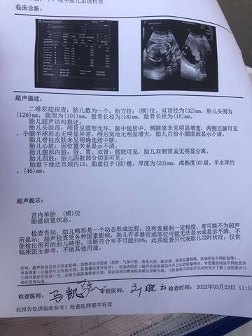 journal_insert_pic_1741022617