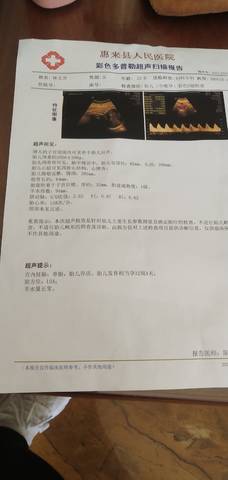 journal_insert_pic_1676713669