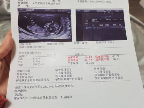 journal_insert_pic_1678703713