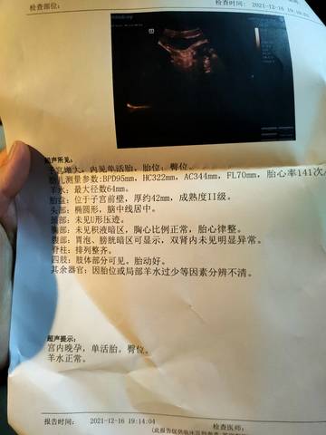 journal_insert_pic_1681254854