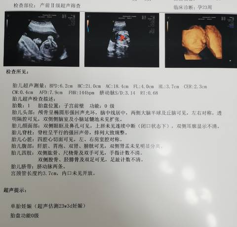 journal_insert_pic_1683668431