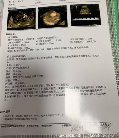 journal_insert_pic_1689787584