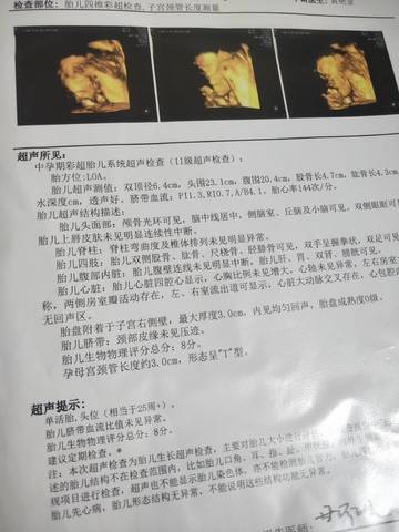 journal_insert_pic_1719461654
