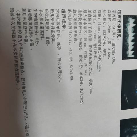 journal_insert_pic_1688571161