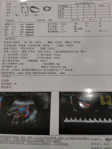 journal_insert_pic_1678190668