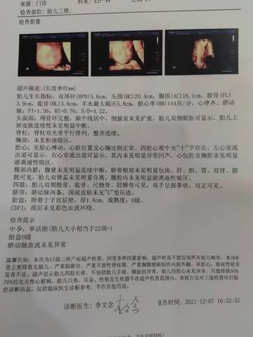 journal_insert_pic_1675702103