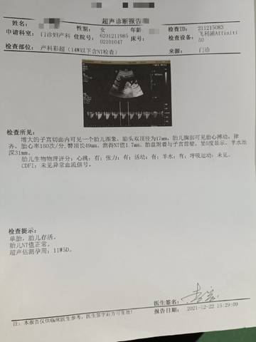 journal_insert_pic_1684449483