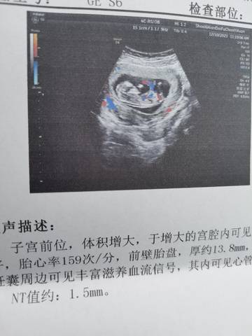 journal_insert_pic_1677338509