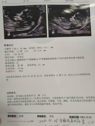 journal_insert_pic_1684587316